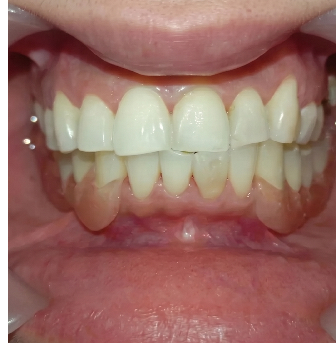 Estética dental y diseño
