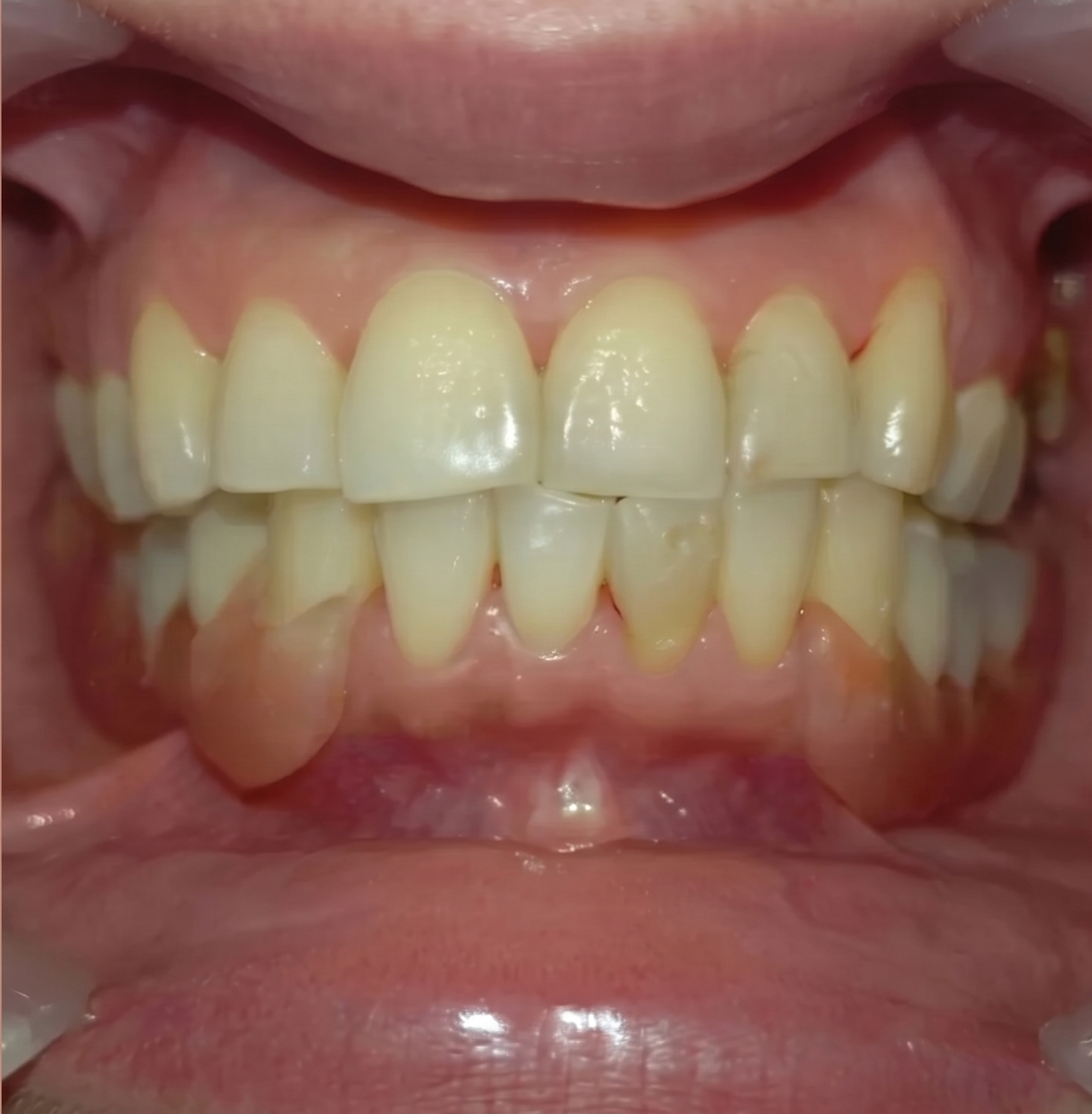Previsualización neutral de arte dental, no caso clínico